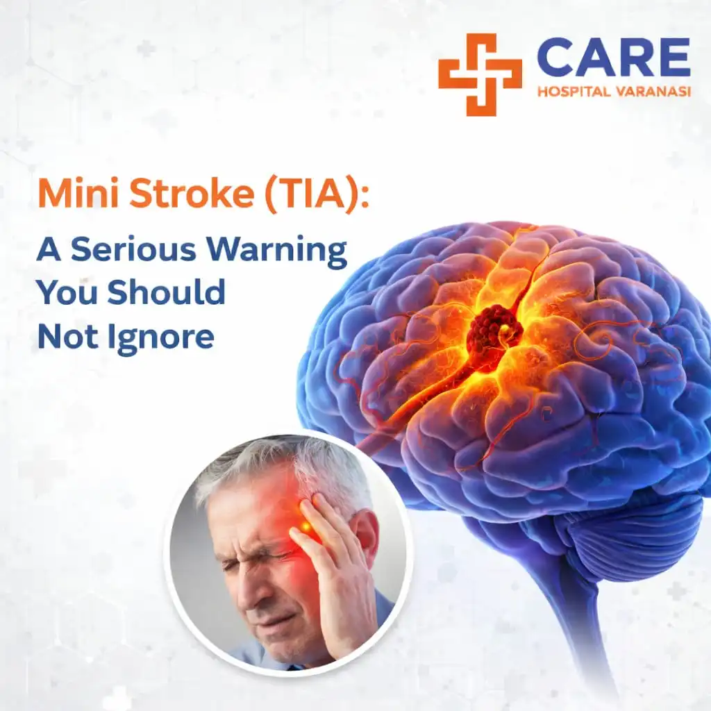 Infographic about mini stroke (TIA) as a serious warning sign, showing a brain with reduced blood flow and a man holding his head, by Care Hospital Varanasi.