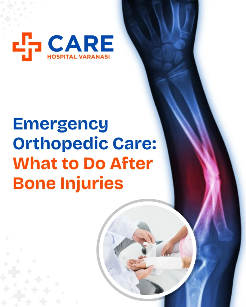 Emergency orthopedic care awareness graphic from Care Hospital Varanasi showing an X-ray style image of a forearm with a highlighted fracture, an inset of a doctor applying a bandage to an injured arm, and the headline “Emergency Orthopedic Care: What to Do After Bone Injuries.”