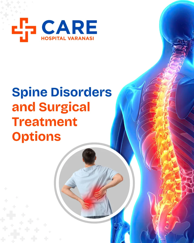 Spine care awareness graphic from Care Hospital Varanasi showing an anatomical illustration of the human spine highlighted with pain and inflammation, an inset of a person holding their lower back in pain, and the headline “Spine Disorders and Surgical Treatment Options.”