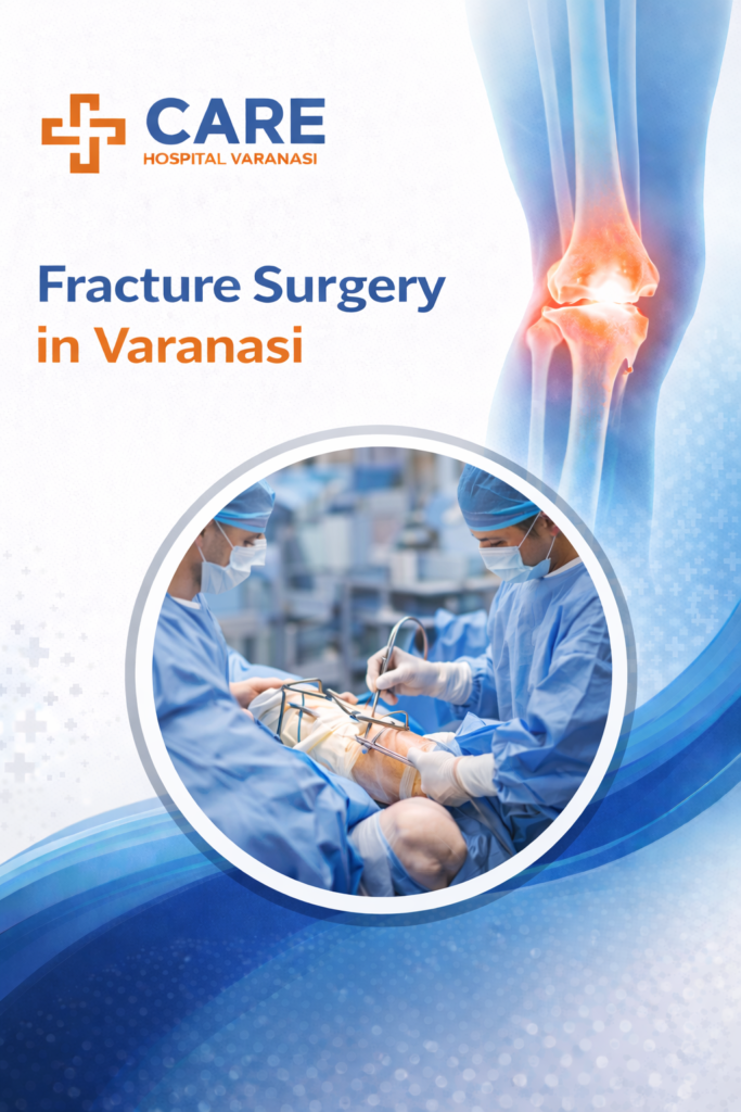 Fracture Surgery in Varanasi promotional poster by CARE Hospital Varanasi featuring highlighted knee fracture illustration and large circular image of orthopedic surgeons performing fracture surgery with blue and orange medical theme design.